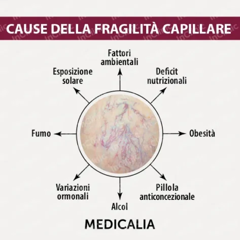 cause della fragilità capillare infografica