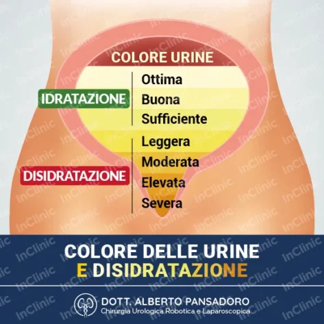 colore delle urine infografica