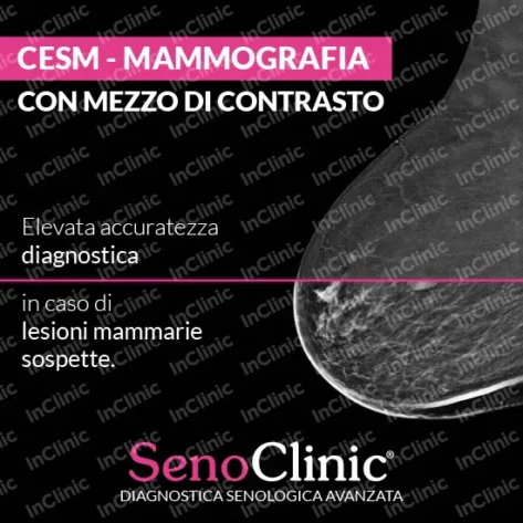 infografica mammografia con mezzo di contrasto