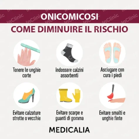 infografiche mediche onicomicosi
