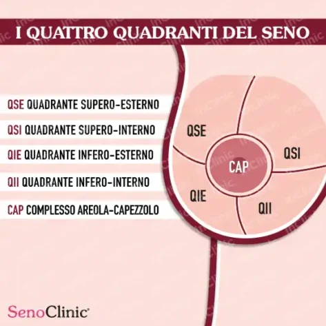 infografiche mediche quadranti seno